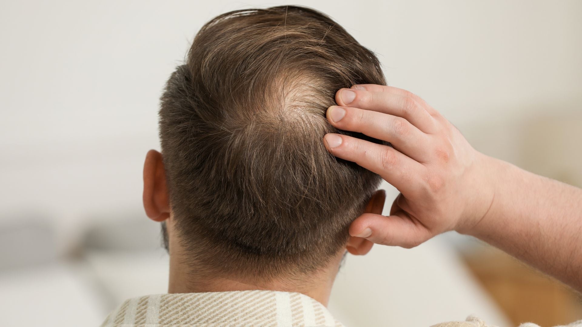 Man with bald spot